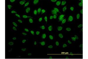 Immunofluorescence of monoclonal antibody to ROD1 on HeLa cell. (PTBP3 抗体  (AA 16-114))