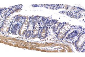 Detection of MYH11 in Rat Colon Tissue using Polyclonal Antibody to Myosin Heavy Chain 11, Smooth Muscle (MYH11) (MYH11 抗体  (AA 1-351))