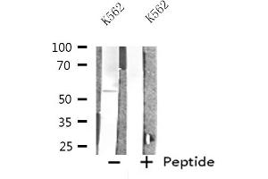 Western blot analysis of extracts from K562 cells, using INA antibody. (INA 抗体  (Internal Region))