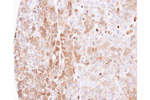 IHC-P Image Immunohistochemical analysis of paraffin-embedded FaDu xenograft, using LXN, antibody at 1:500 dilution. (Latexin 抗体)