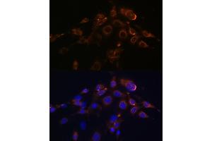 Immunofluorescence analysis of NIH-3T3 cells using DR5/TR/TNFRSF10B Rabbit mAb (ABIN7271062) at dilution of 1:100 (40x lens). (TNFRSF10B 抗体)