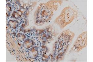 Immunohistochemistry (IHC) image for anti-Glial Fibrillary Acidic Protein (GFAP) (pSer38) antibody (ABIN6256306)