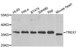 Western blot analysis of extracts of various cell lines, using TREX1 antibody. (TREX1 抗体  (AA 1-270))
