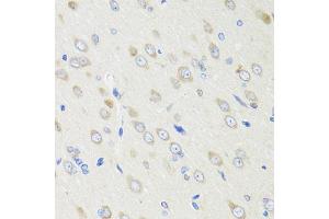 Immunohistochemistry of paraffin-embedded rat brain using CRABP2 antibody (ABIN1882301) at dilution of 1:100 (40x lens). (CRABP2 抗体)
