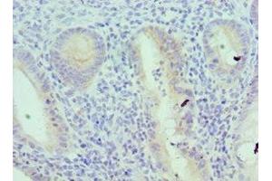 Immunohistochemistry of paraffin-embedded human epityphlon tissue using ABIN7156833 at dilution of 1:100 (IL18RAP 抗体  (AA 390-599))