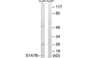 Western blot analysis of extracts from HuvEc cells, using S100A7L2 Antibody. (S100A7L2 抗体  (AA 38-87))