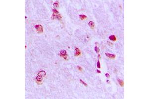 Immunohistochemical analysis of ARHGAP18 staining in human brain formalin fixed paraffin embedded tissue section. (ARHGAP18 抗体  (C-Term))