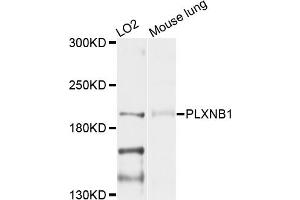 Western blot analysis of extracts of various cell lines, using PLXNB1 antibody (ABIN4904796) at 1:1000 dilution. (PLXNB1 抗体)