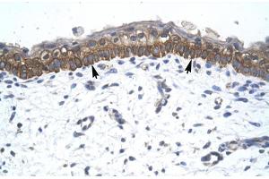 Human Skin; ZNF385 antibody - C-terminal region in Human Skin cells using Immunohistochemistry (ZNF385A 抗体  (C-Term))