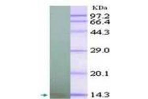 Image no. 2 for anti-Chemokine (C-X-C Motif) Ligand 10 (CXCL10) antibody (ABIN791563) (CXCL10 抗体)