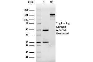 SDS-PAGE Analysis Purified TFF1/ps2 Mouse Monoclonal Antibody (rTFF1/1091). (Recombinant TFF1 抗体)