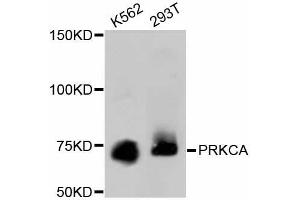 Western blot analysis of extracts of various cell lines, using PRKCA antibody (ABIN5997085). (PKC alpha 抗体)