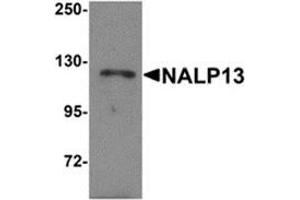 Western blot analysis of NALP13 in K562 cell lysate with NALP13 antibody at 1 μg/ml. (NLRP13 抗体  (N-Term))