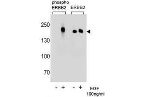 Western blot analysis of extracts from A431 cells, untreated or treated with EGF (100ng/ml) using p-ERBB2 antibody (left) or nonphos Ab (right) (ErbB2/Her2 抗体  (pTyr1196))