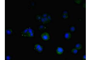 Immunofluorescent analysis of MCF-7 cells using ABIN7172947 at dilution of 1:100 and Alexa Fluor 488-congugated AffiniPure Goat Anti-Rabbit IgG(H+L) (TM9SF1 抗体  (AA 28-230))