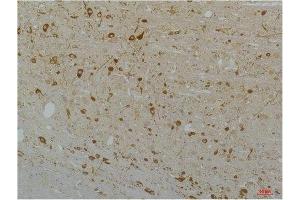 Immunohistochemical analysis of paraffin-embedded Rat Brain Tissue using Cav1. (CACNA1D 抗体)