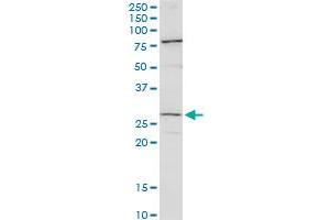 CFDP1 polyclonal antibody (A01). (CFDP1 抗体  (AA 168-251))