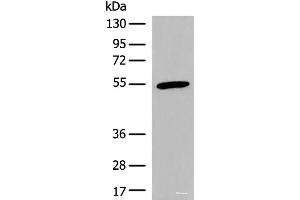 Western blot analysis of Human heart tissue lysate using CIR1 Polyclonal Antibody at dilution of 1:600 (CIR1 抗体)