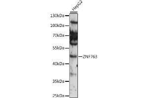 Western blot analysis of extracts of various cell lines, using ZNF763 antibody (ABIN7271529) at 1:1000 dilution. (ZNF763 抗体  (AA 315-370))