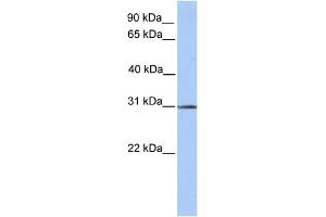 WB Suggested Anti-SURF4 Antibody Titration:  0. (Surfeit 4 抗体  (N-Term))