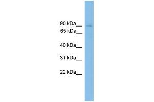 WB Suggested Anti-HNRNPU Antibody Titration:  0. (HNRNPU 抗体  (C-Term))