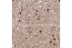 Immunohistochemical staining of human cerebral cortex with SIPA1L1 polyclonal antibody  shows strong nuclear positivity in neuronal cells. (SIPA1L1 抗体)