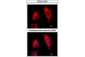 Image no. 4 for anti-Eukaryotic Translation Elongation Factor 1 delta (Guanine Nucleotide Exchange Protein) (EEF1D) (AA 310-647) antibody (ABIN1497948)
