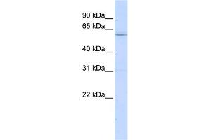 WB Suggested Anti-LRRC15 Antibody Titration:  0. (LRRC15 抗体  (N-Term))