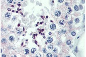 Human Testis: Formalin-Fixed, Paraffin-Embedded (FFPE) (PRDM9 抗体  (AA 431-480))
