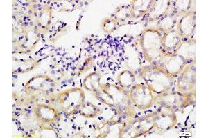 Formalin-fixed and paraffin embedded rat kidney tissue labeled with Anti-GPIIb Polyclonal Antibody, Unconjugated at 1:200 followed by conjugation to the secondary antibody, (SP-0023), and DAB staining (Integrin Alpha2b 抗体  (AA 351-450))