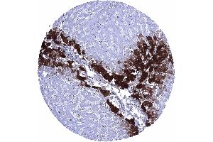Glutamine Synthetase staining is strong in centrilobular hepatocytes weak to moderate in Kupffer cells but absent in periportal hepatocytes (GLN1 抗体  (AA 50-250))