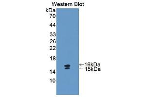 Western blot analysis of the recombinant protein. (Vip 抗体  (AA 34-157))