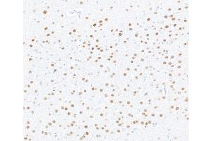 Immunohistochemistry (IHC) image for anti-Myocyte Enhancer Factor 2C (MEF2C) (AA 425-475) antibody (ABIN7795747) (Recombinant MEF2C 抗体  (AA 425-475))