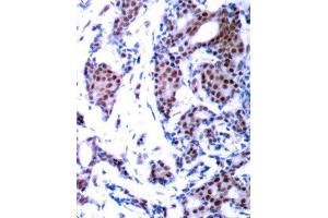 Immunohistochemistry (IHC) image for anti-Jun Proto-Oncogene (JUN) (pSer73) antibody (ABIN3019560)