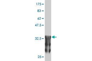 Western Blot detection against Immunogen (37. (ANKRD17 抗体  (AA 2501-2603))