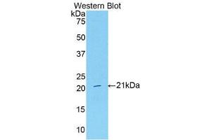 Western Blotting (WB) image for anti-Serpin Peptidase Inhibitor, Clade G (C1 Inhibitor), Member 1 (SERPING1) (AA 35-179) antibody (ABIN3208986) (SERPING1 抗体  (AA 35-179))