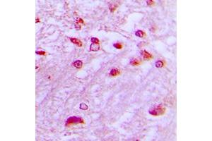 Immunohistochemical analysis of DYRK1A staining in human brain formalin fixed paraffin embedded tissue section. (DYRK1A 抗体  (N-Term))