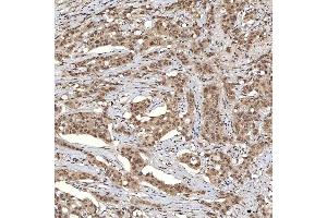 IHC analysis of U1A/SNRPA using anti-U1A/SNRPA antibody (ABIN7600891). (SNRPA1 抗体  (AA 25-218))
