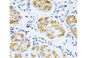 Immunohistochemistry (Paraffin-embedded Sections) (IHC (p)) image for anti-Cytochrome P450, Family 2, Subfamily E, Polypeptide 1 (CYP2E1) antibody (ABIN7260247)