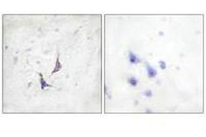 Immunohistochemistry analysis of paraffin-embedded human brain tissue using Syndecan4 (Ab-179) antibody. (SDC4 抗体  (Ser179))