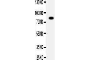 Anti-ADAM2 antibody, Western blotting WB: SMMC Cell Lysate (ADAM2 抗体  (C-Term))