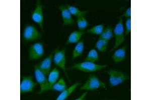 IF analysis of IRS2 using anti-IRS2 antibody (ABIN7601988).