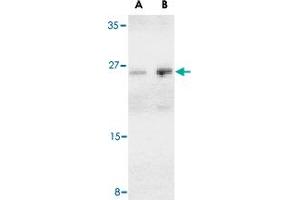 Western blot analysis of BCAP29 in human heart tissue lysate with BCAP29 polyclonal antibody  at (A) 1 and (B) 2 ug/mL . (BCAP29 抗体  (Internal Region))