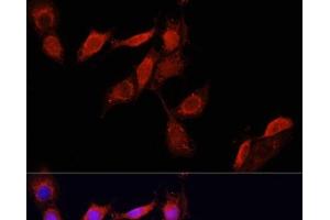 Immunofluorescence analysis of NIH/3T3 cells using GPER1 Polyclonal Antibody at dilution of 1:100. (Mesothelin 抗体)