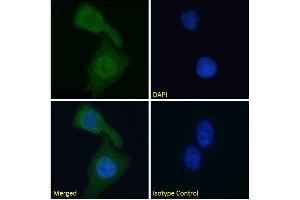 Immunofluorescence staining of fixed HeLa cells with anti-Cardiac Troponin I antibody scFv 180. (Recombinant TNNI3 抗体)
