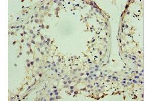 Immunohistochemistry of paraffin-embedded human testis tissue using ABIN7169001 at dilution of 1:100