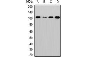 Western blot analysis of Sec5 expression in MCF7 (A), Hela (B), mouse lung (C), rat brain (D) whole cell lysates. (EXOC2 抗体)