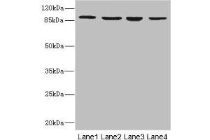 Western blot All lanes: ITGB7 antibody at 5. (Integrin beta 7 抗体  (AA 1-140))