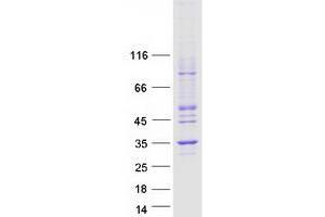 Nucleotide Binding Protein 2 (NUBP2) protein (Myc-DYKDDDDK Tag)