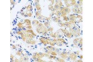 Immunohistochemistry of paraffin-embedded Human stomach using INADL Polyclonal Antibody at dilution of 1:100 (40x lens). (PATJ 抗体)